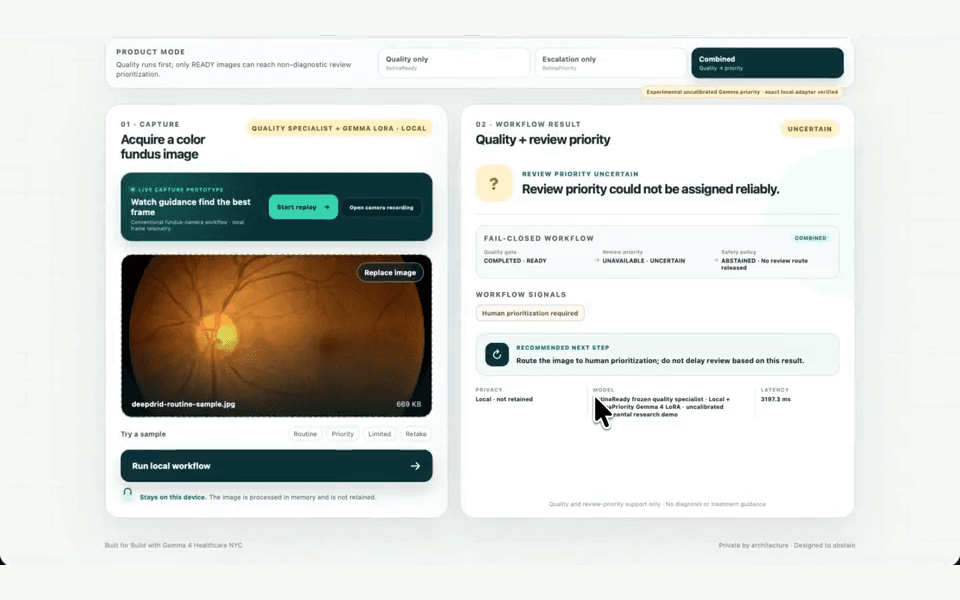 RetinaReady web interface showing a captured fundus photograph beside the quality and review-priority workflow result